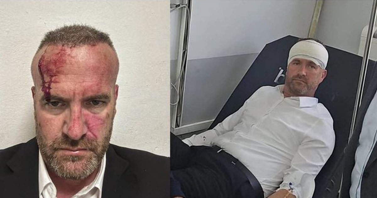 Çfarë ndodhi në Skenderaj? Foto e gjakosur dhe dy versione misterioze